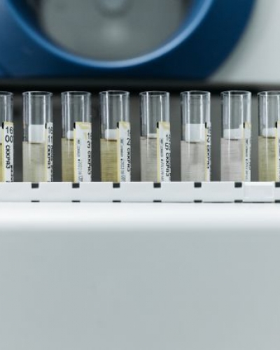 Water quality monitoring
